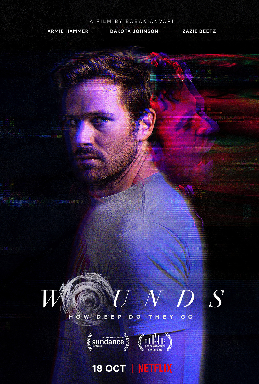 Extra Large TV Poster Image for Wounds 