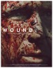 The Wound